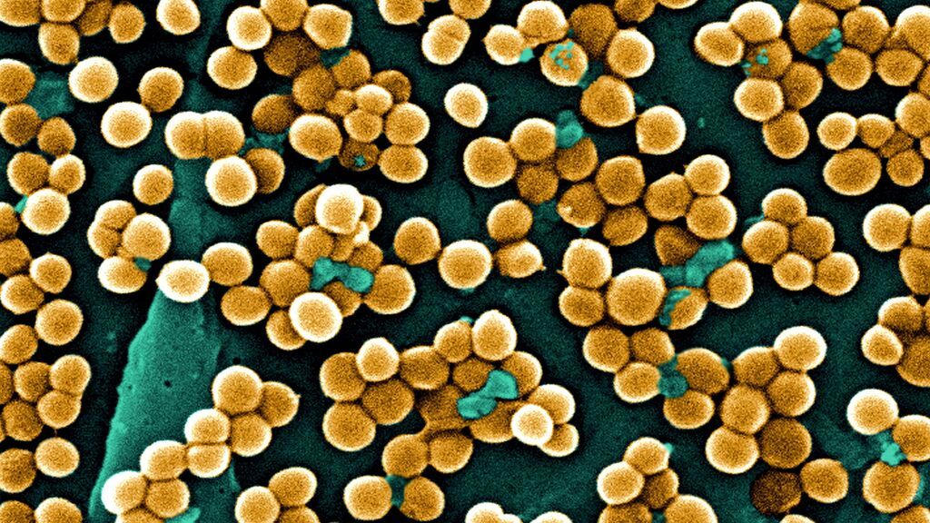 Detallan cómo se propaga el estafilococo 'aureus', una superbacteria letal NIUS Detallan cómo se propaga el estafilococo 'aureus', una superbacteria letal NIUS