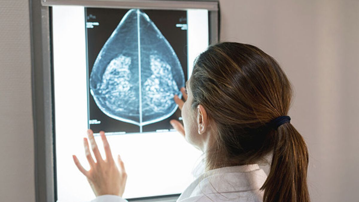 Un nuevo fármaco frena el avance del cáncer de mama metastásico en un 75,8% Un nuevo fármaco frena el avance del cáncer de mama metastásico en un 75,8%