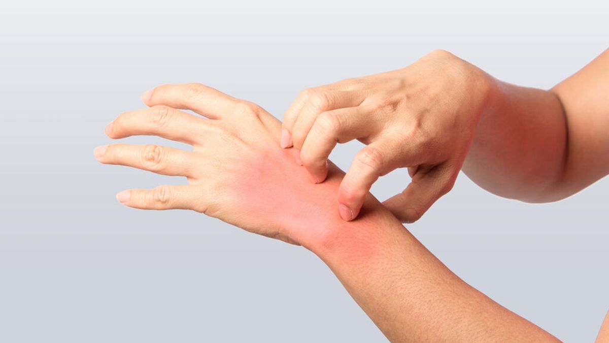 ¿Por qué se produce el eczema de manos y cómo evitar que aparezca?