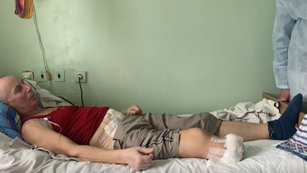 Las brutales condiciones en las que atienden a los heridos de la guerra de Ucrania: llegan con sus huesos colgando