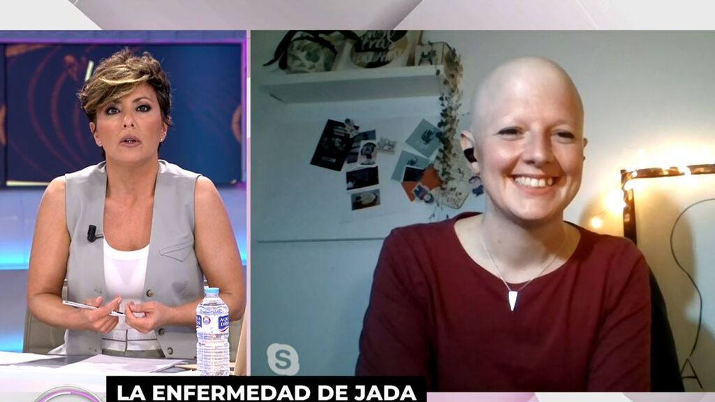 Julia Vincent nos habla sobre la alopecia femenina