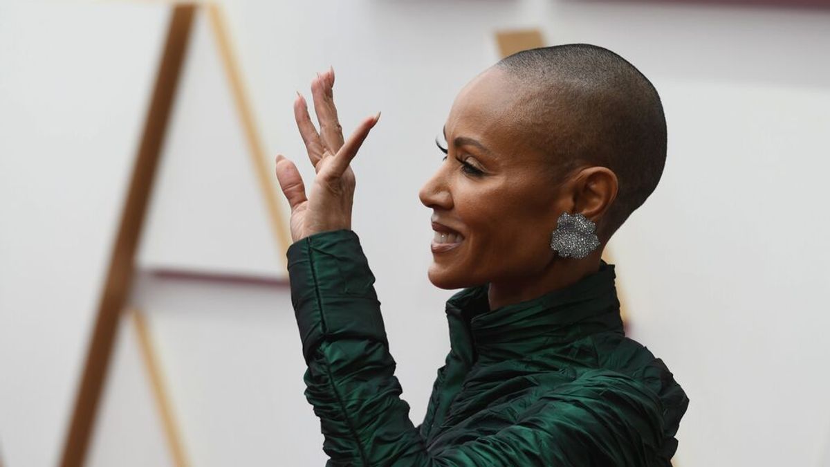 Qué es el trastorno autoinmune de alopecia que sufre la mujer de Will Smith Qué es el trastorno autoinmune de alopecia que sufre la mujer de Will Smith