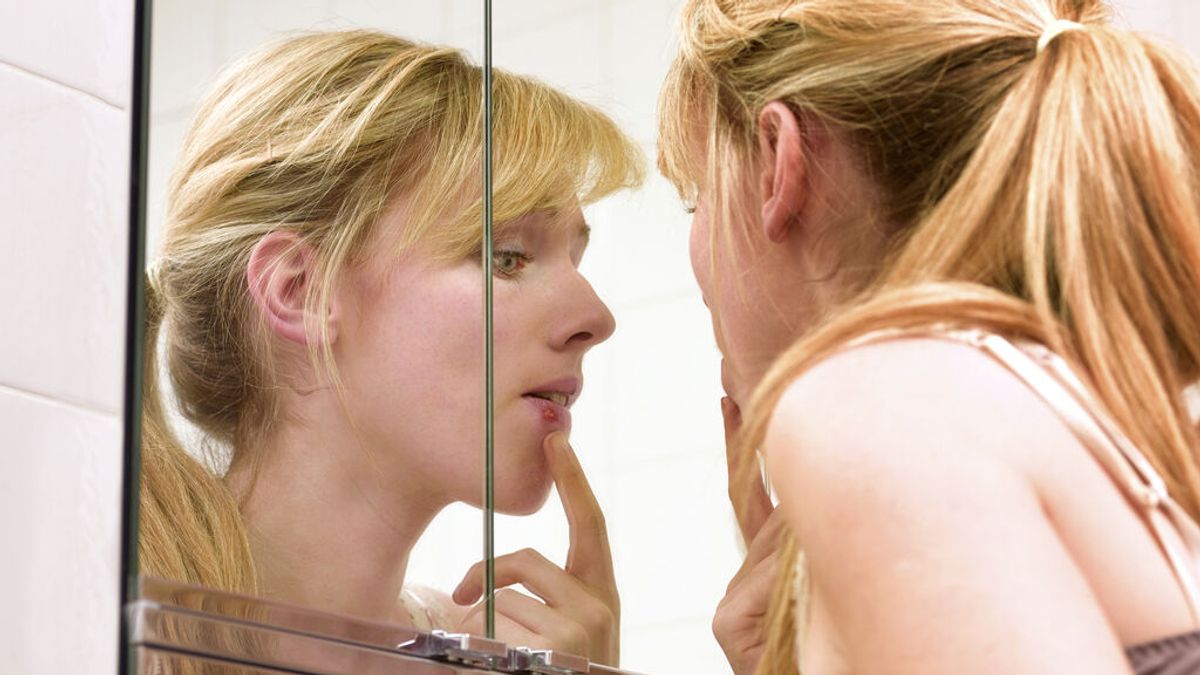 ¿Por qué se hinchan los labios y cuándo acudir al médico? Estas son las causas más comunes