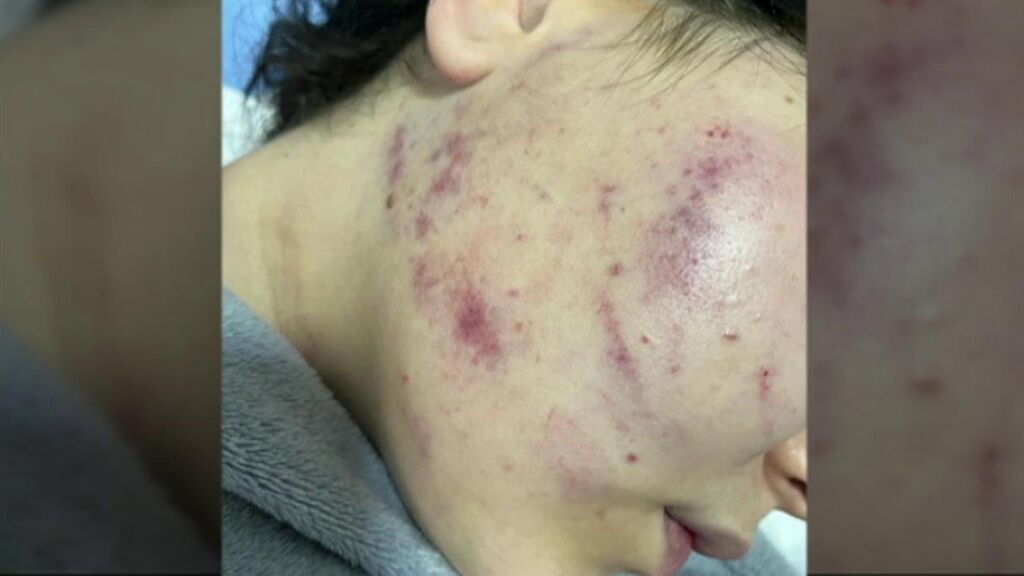 Un joven da una brutal paliza a su pareja, de 17 años, en Jerez de la Frontera