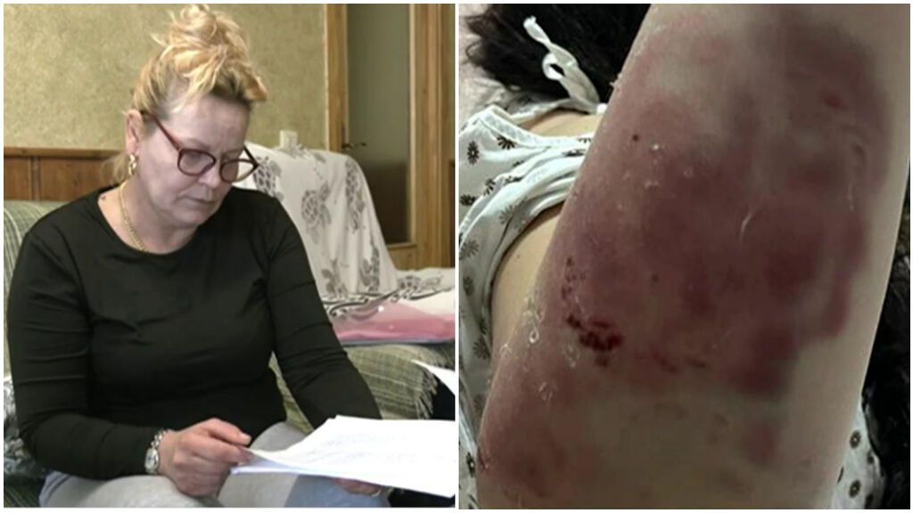 La madre de la joven que sufrió una brutal paliza de su novio en Jerez explicó cómo fue la agresión