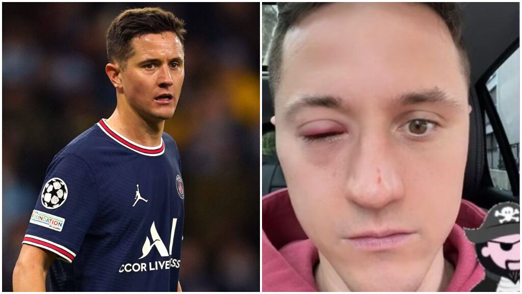 La conjuntivitis viral que ha apartado a Ander Herrera del fútbol casi tres semanas