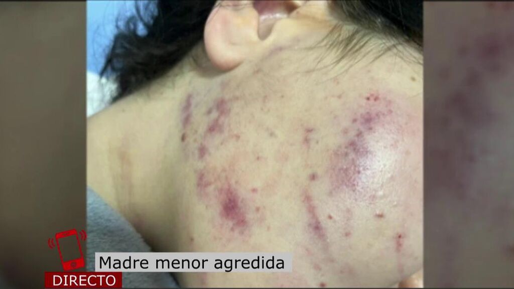 El desgarrador testimonio de la madre de la menor brutalmente agredida en Jerez