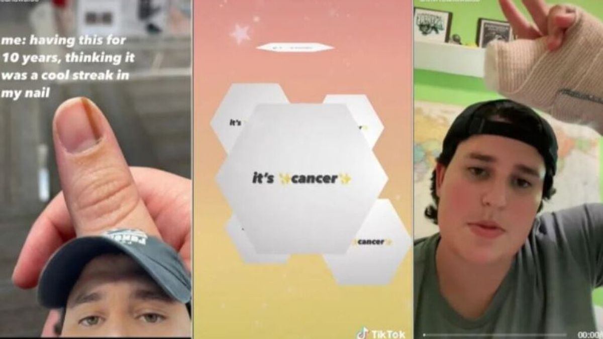 Una joven estadounidense explica en TikTok cómo descubrió que tenía un cáncer en su uña