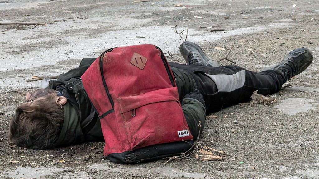 Cómo es la guerra desde un quirófano en Mariúpol: "Jamás vi heridas tan graves"