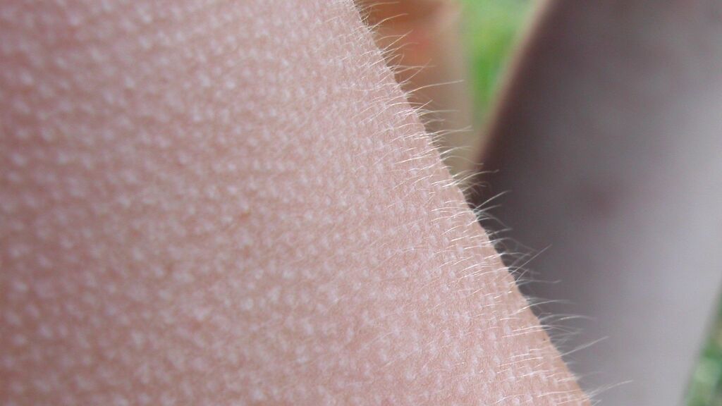 Investigadores desarrollan un método para "saltar en el tiempo" las células de la piel humana 30 años