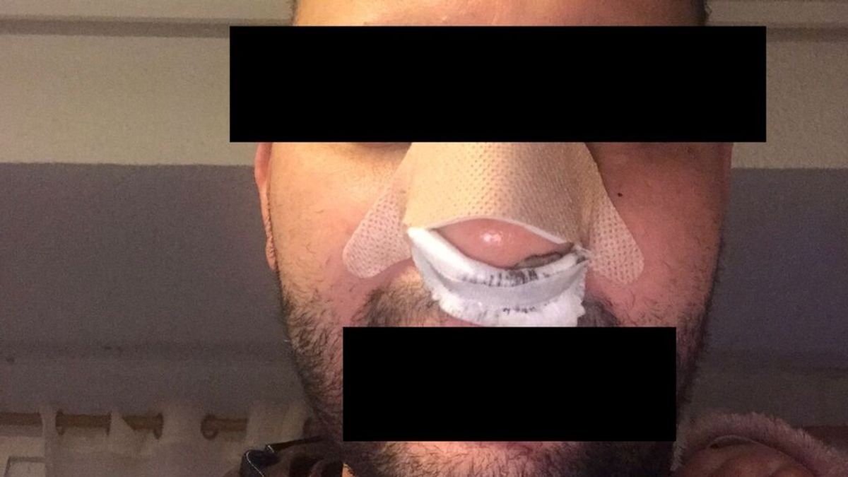 Un marroquí denuncia una agresión de los vigilantes de una discoteca de Valencia: "Moro de mierda. Te mato" Un marroquí denuncia una agresión de los vigilantes de una discoteca de Valencia: "Moro de mierda. Te mato"