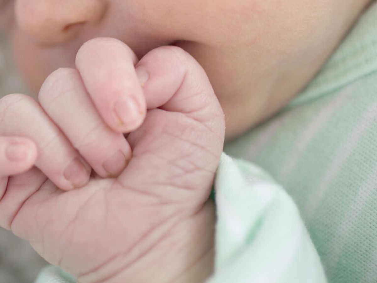 Nace un niño con dos penes en Brasil