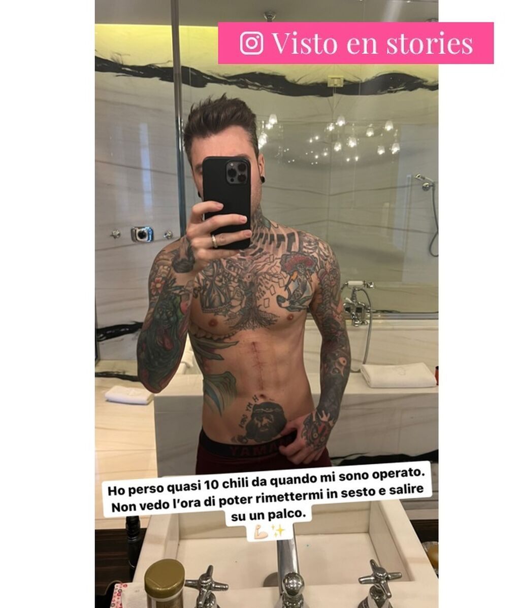 El gran cambio físico de Fedez tras su operación