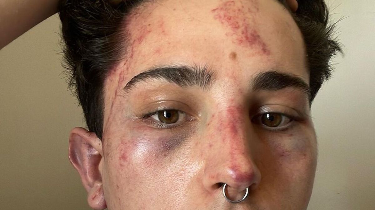 Un joven denuncia una agresión homófoba en una discoteca de Valencia al grito de "maricón de mierda"