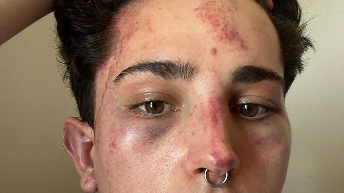 Un joven denuncia una agresión homófoba en una discoteca de Valencia al grito de "maricón de mierda" Un joven denuncia una agresión homófoba en una discoteca de Valencia al grito de "maricón de mierda"