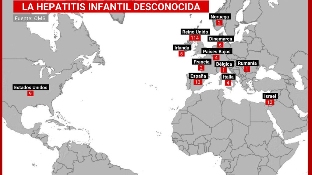 El mapa de la hepatitis infantil de origen desconocido