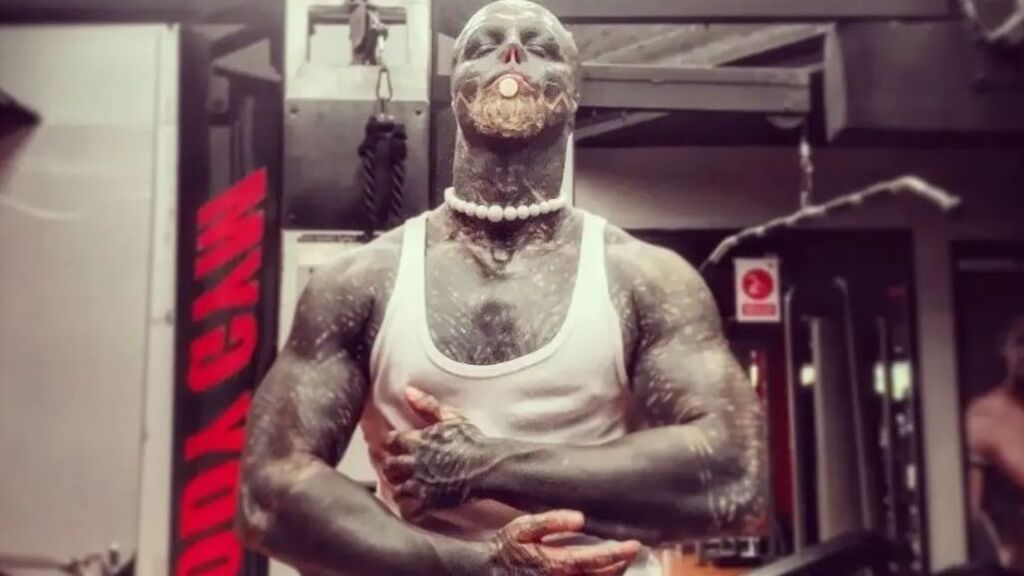 El hombre-alien dice ahora que quiere amputarse una pierna para completar su transformación