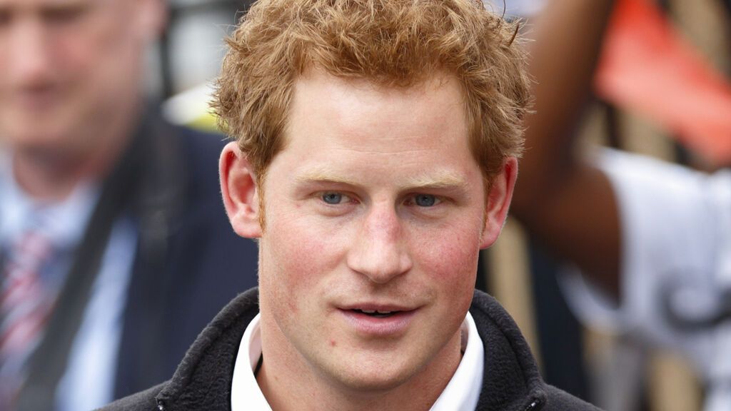 El príncipe Harry padece rosácea.