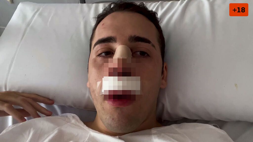 Jorge Cyrus se somete a una operación de nariz (2/2)