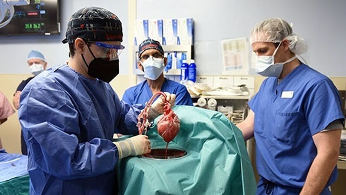 El corazón de cerdo del primer trasplante a un humano que murió en dos meses tenía un virus porcino El corazón de cerdo del primer trasplante a un humano que murió en dos meses tenía un virus porcino