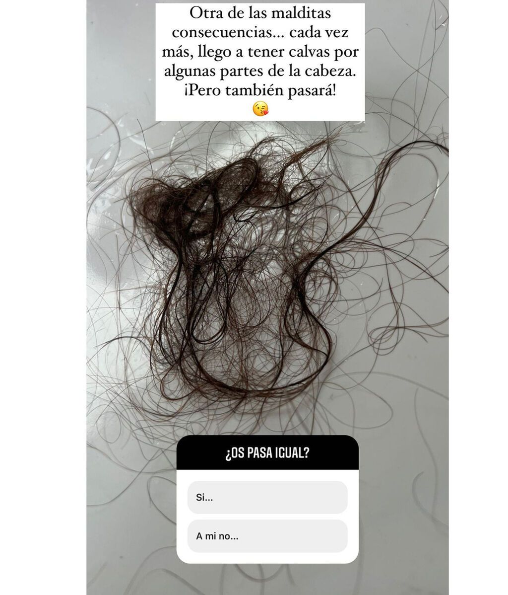Tamara Gorro ha mostrado su alarmante pérdida de pelo en los últimos tiempos