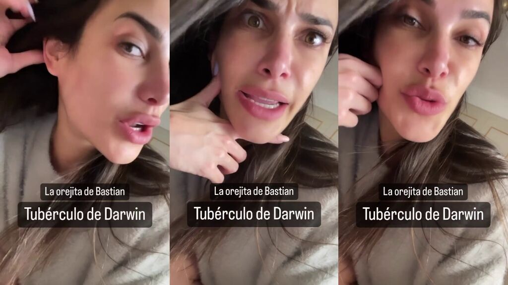 carla-barber-sindrome-darwin