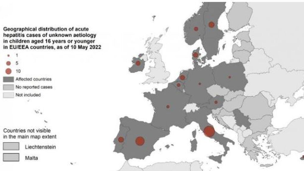 Los pediatras piden calma: España es el segundo país de la UE con más casos de hepatitis infantil graveE