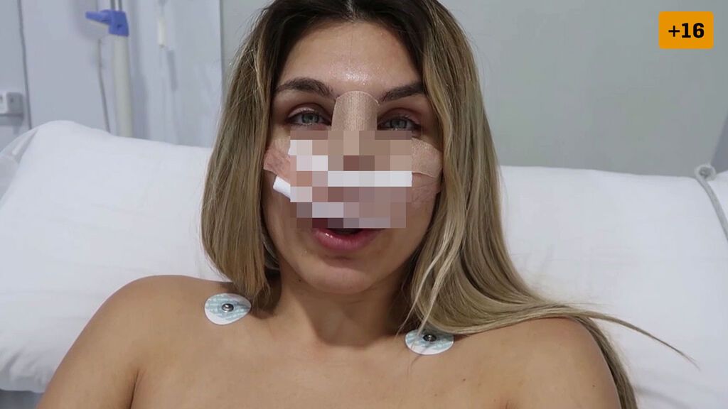 Ivana Icardi se somete a una rinoplastia para corregir su nariz (2/2)
