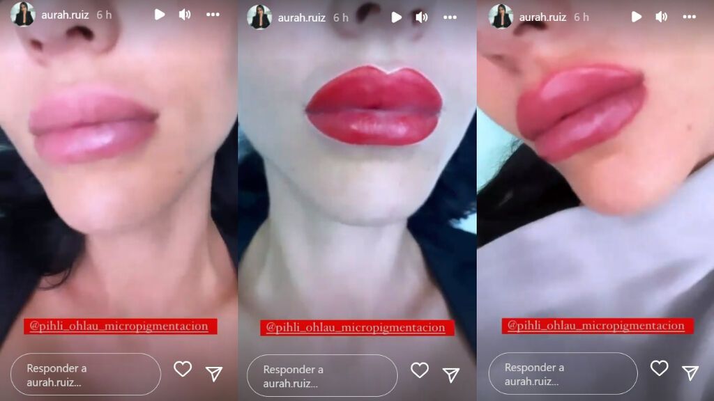 AurahLabios