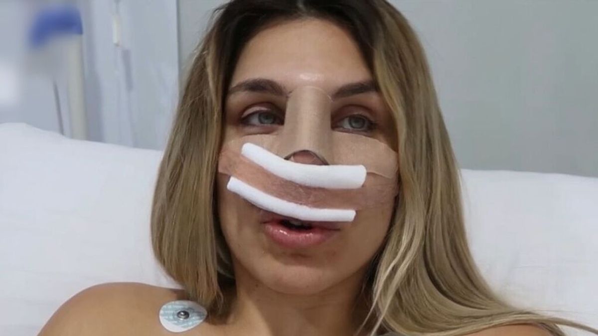 Ivana Icardi reaparece tras someterse a una rinoplastia: "Quiero dar dulzura a mi cara"