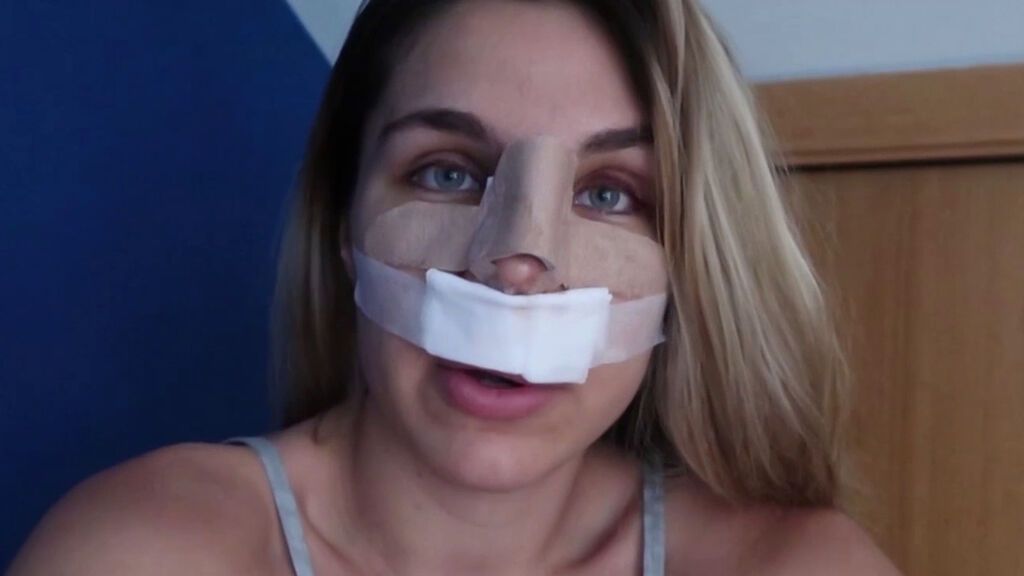 Ivana Icardi muestra el asombroso resultado de su rinoplastia: "Nunca me vi la nariz tan derecha"