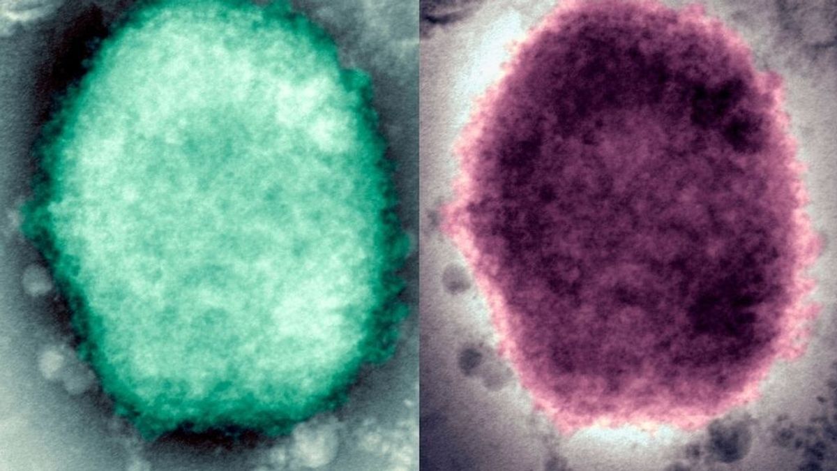 Cómo evitar el contagio por la viruela del mono Cómo evitar el contagio por la viruela del mono