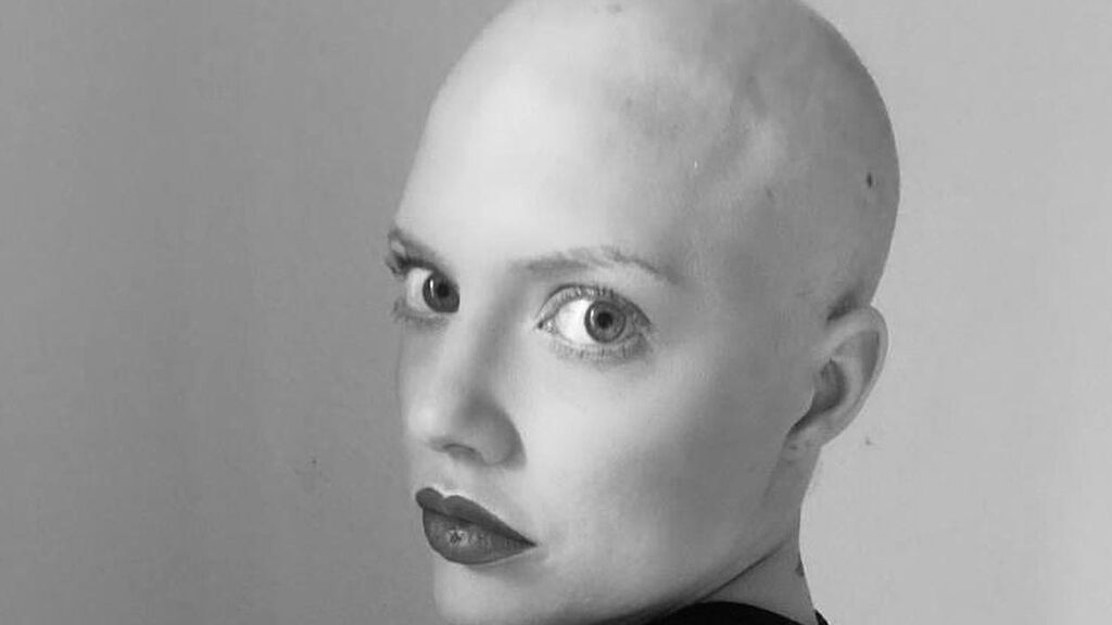 Patricia Rite se sincera sobre su cáncer de piel: “Mi madre me ha ayudado a pagarme la vida”