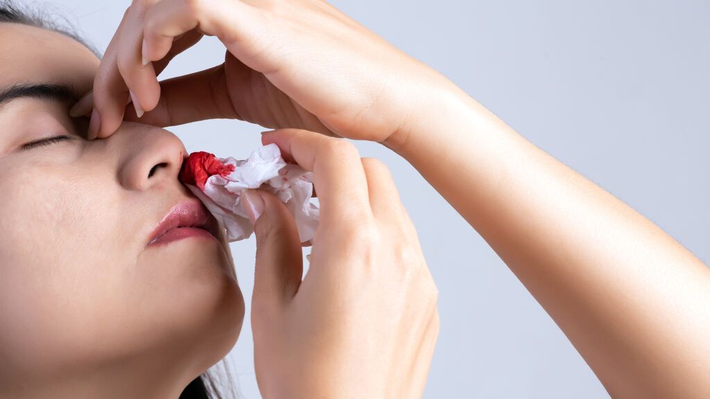 ¿Te sangra la nariz? Estos son los motivos que pueden causarlo y cómo actuar
