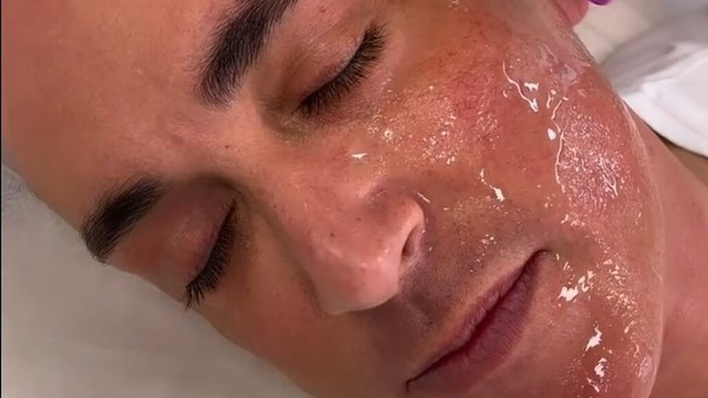 Kiko Hernández muestra su nuevo retoque estético