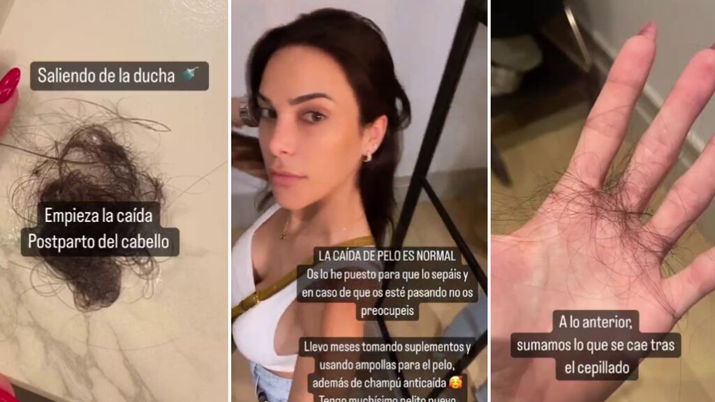 Carla Barber muestra la preocupante caída de pelo que está sufriendo