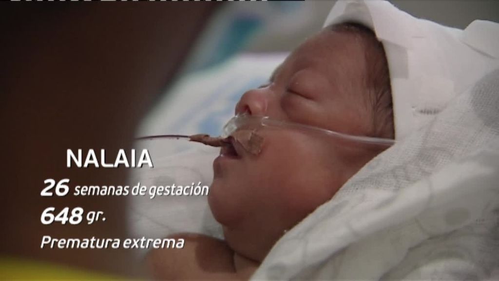 La historia de superación de Nalaia, una prematura que nació a las 26 semanas por el covid grave de su madre