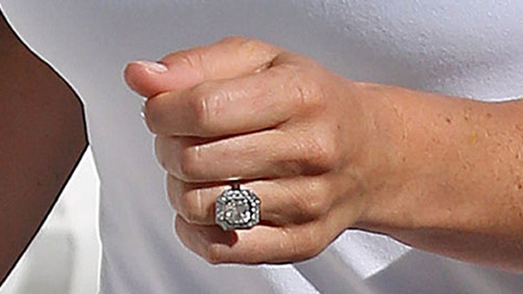 anillo