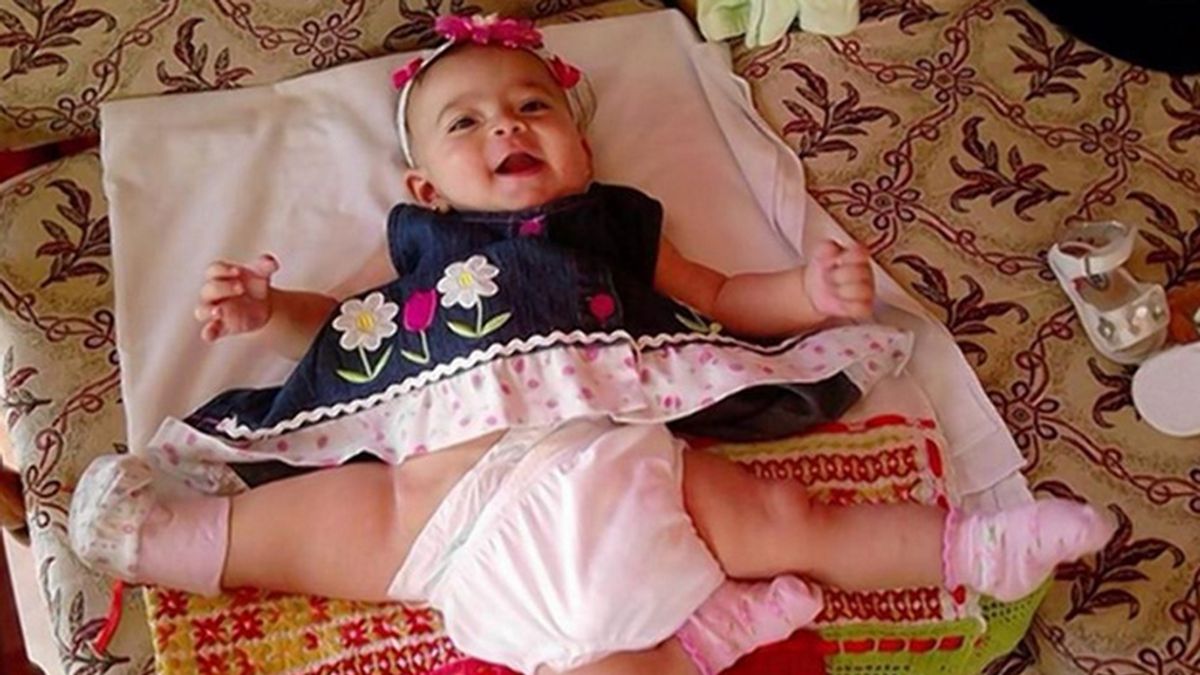 Ana Paula, la niña de tres piernas será operada