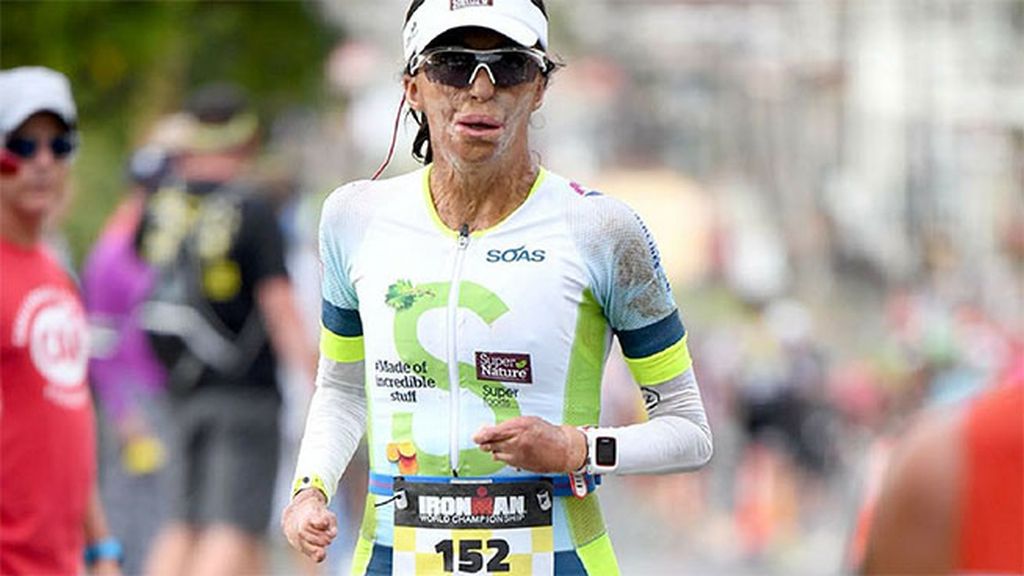 Turia Pitt Turia Pitt