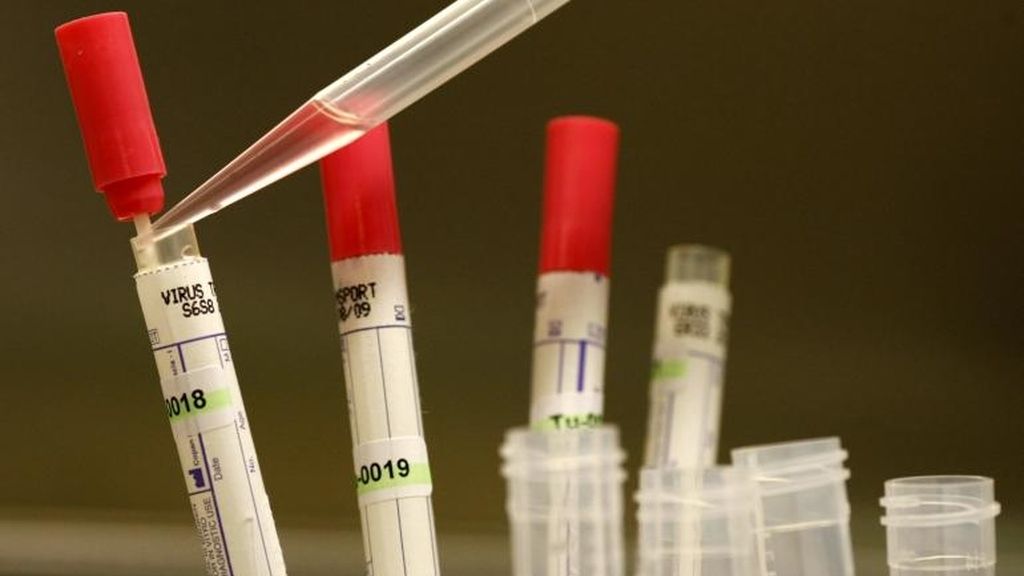 Zmapp, ébola, epidemia de ébola, investigaciones del ébola