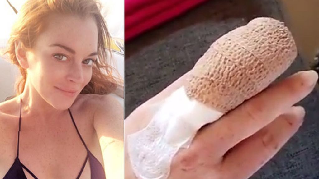 lindsay dedo