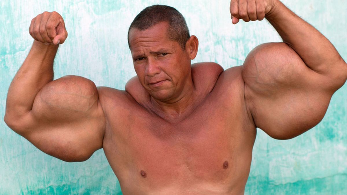 El hombre con los bíceps más grandes de Brasil