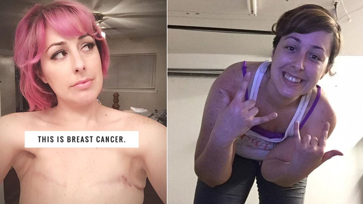 Una madre con doble mastectomía enseña lo que es ser una verdadera superviviente