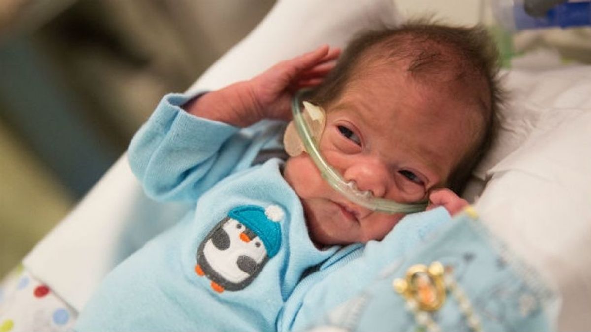 Angel nacio gracias a una cesárea mientras su madre estaba en muerte cerebral