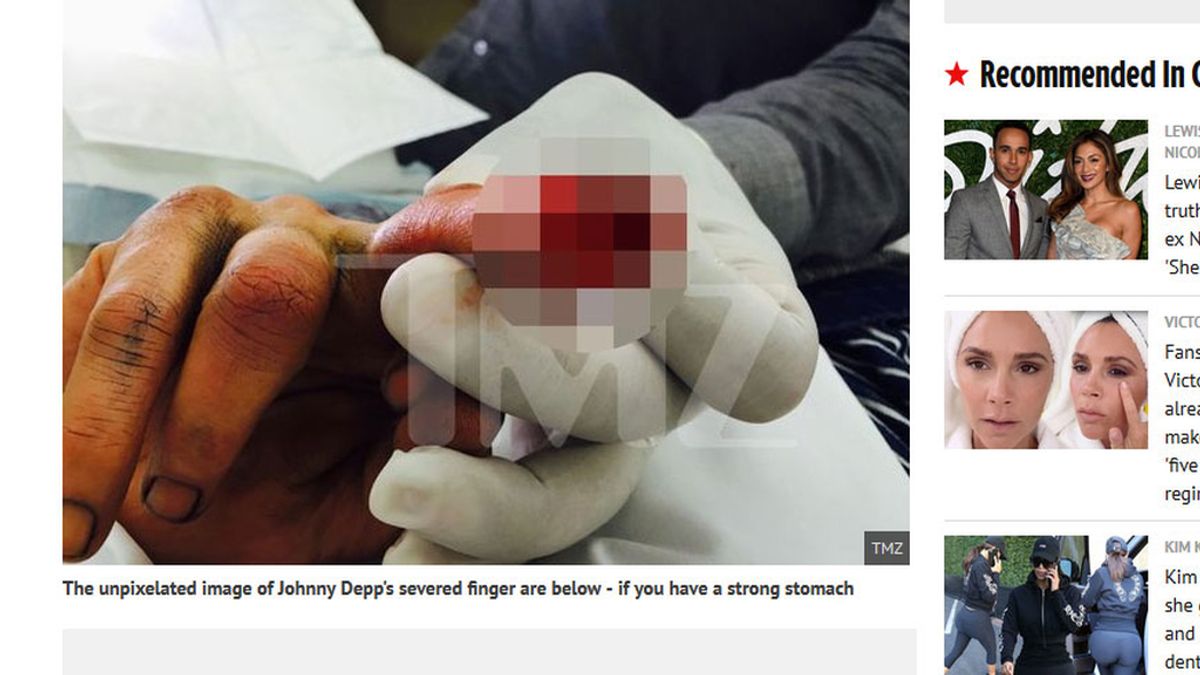 La exmujer de Johnny Depp publica el dedo cortado del actor tras una pelea doméstica