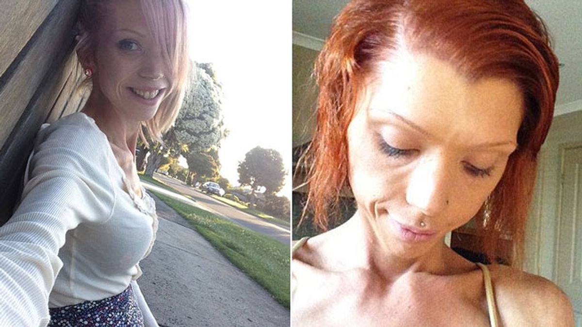 Sufre anorexia por cumplir el deseo de su novio, parecer una actriz porno Sufre anorexia por cumplir el deseo de su novio, parecer una actriz porno