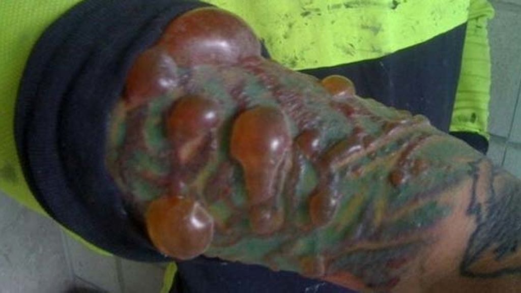 Cuando te tatúa un ‘chapucero’