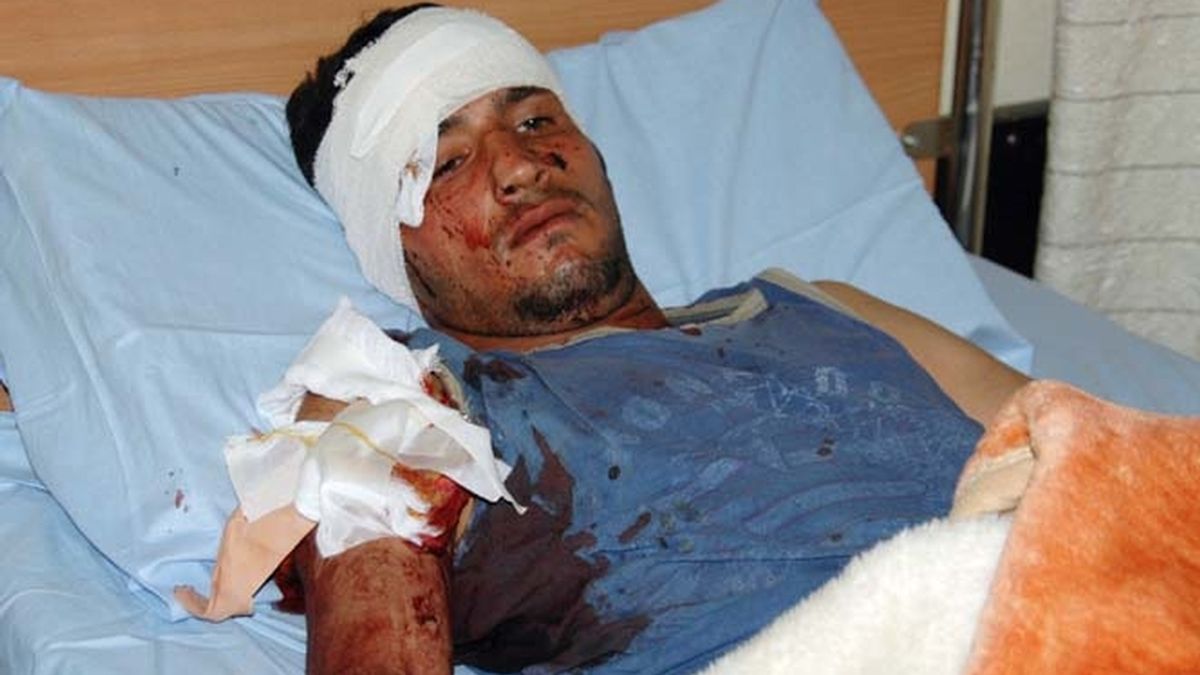 Un civil herido en un hospital de Bagdad tras el doble atentado suicida