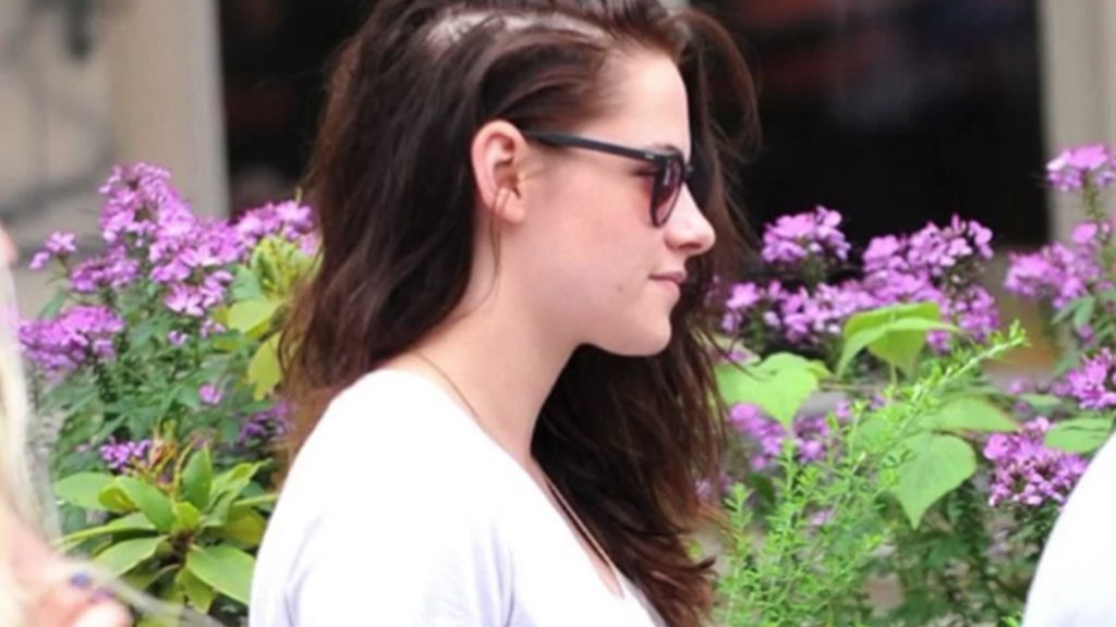 ALOPECIAVIP